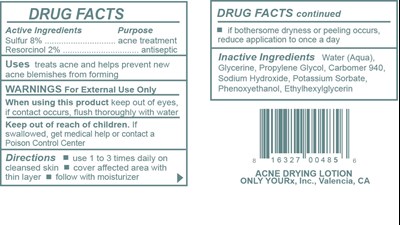 Acne Drying Lotion (Acne Drying Lotion Tag)